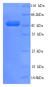 Human TCN1 Protein (Recombinant His)