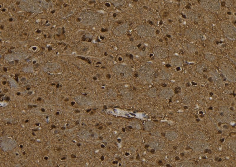 Polyclonal Rabbit anti-Human PPP4C Antibody (IHC, WB)
