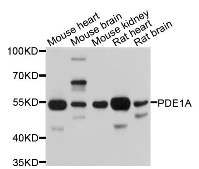 Polyclonal Rabbit anti-Human PDE1A Antibody (WB)