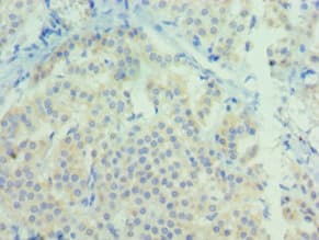 Polyclonal Rabbit anti-Human NTF3 / Neurotrophin 3 Antibody (aa19-257, IHC)