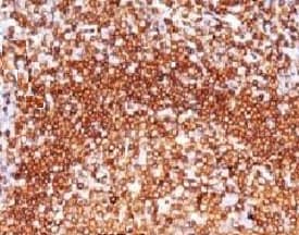 CD79A / CD79 Alpha Antibody (clone CDLA79a-1)