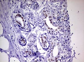 PR / Progesterone Receptor Antibody (aa1-298, clone OTI2F8)