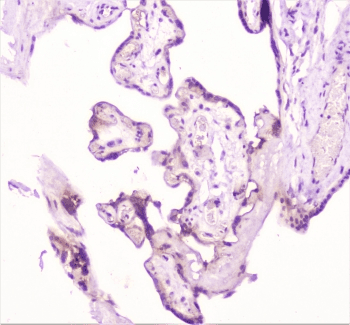 TANK Antibody