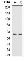 Polyclonal Rabbit anti-Human TRMT2B Antibody (WB)