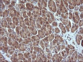 MAP2K3 / MEK3 / MKK3 Antibody (clone OTI5F2)