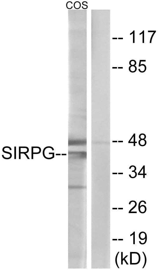SIRPG Antibody (aa101-150)