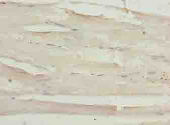 IHC-plus™ SGCA / DAG2 Antibody