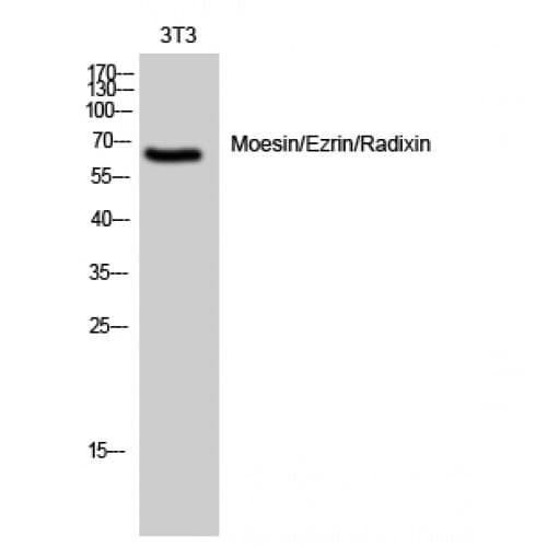 Ezrin + Radixin + Moesin Antibody (500-580 aa)
