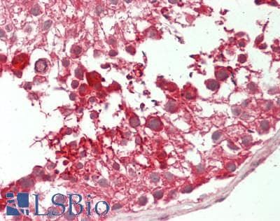 IHC-plus™ PRKAR1A Antibody (C-Terminus)