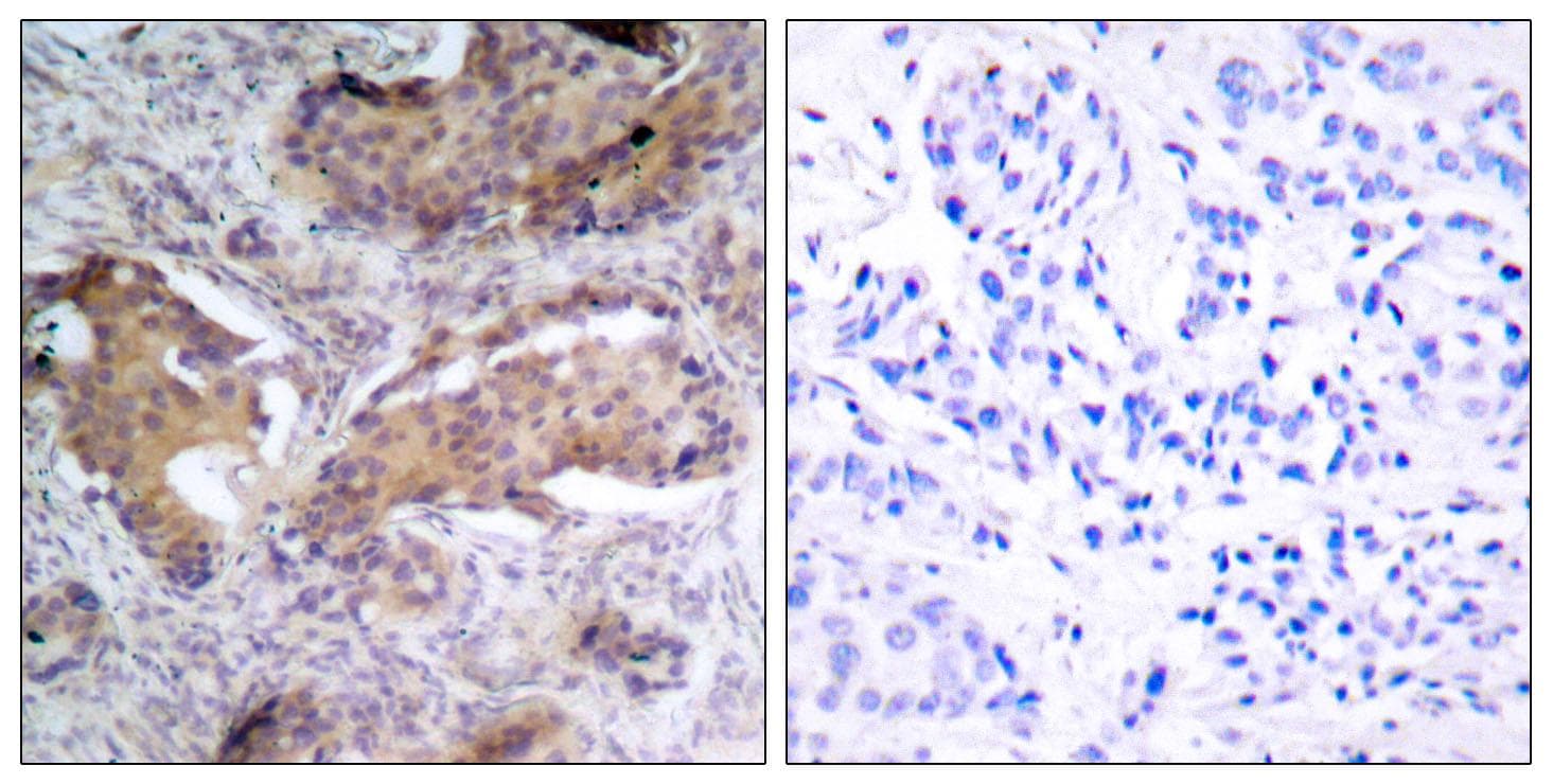 PTEN Antibody (phospho-Ser370)