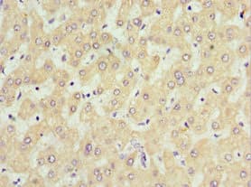 Polyclonal Rabbit anti-Human SOST / Sclerostin Antibody (aa24-213, IHC, WB)
