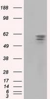 Monoclonal Mouse anti-Human PANK2 Antibody (clone OTI3H9, IHC, IF, WB)