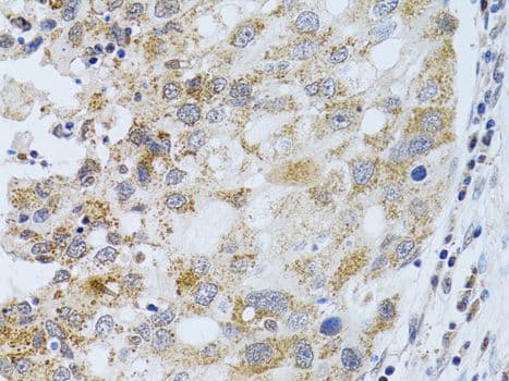 Polyclonal Rabbit anti-Human PHLDA2 / TSSC3 Antibody (IHC, WB)