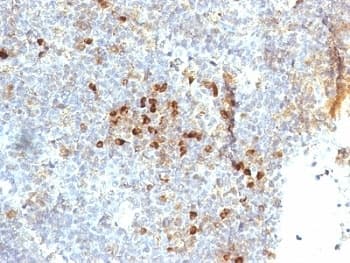 HLA-DR Antibody (clone 19-26.1 or MB-26.1, Ready-to-Use)