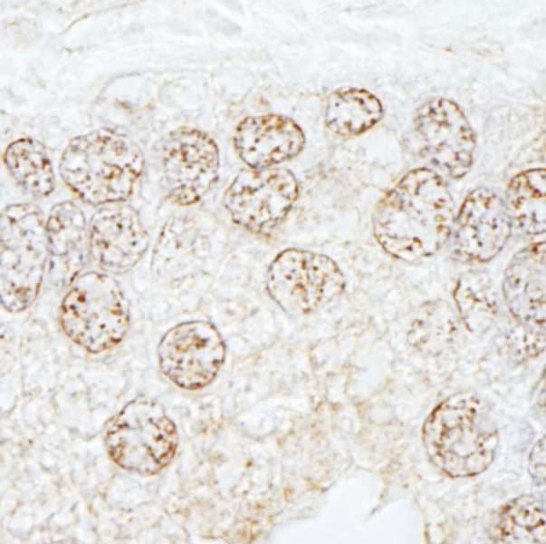 METTL3 Antibody (aa1-50)
