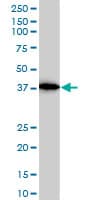 Monoclonal Mouse anti-Human ACTR2 / ARP2 Antibody (clone 1B10-C4, IHC, WB)