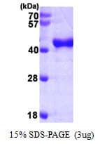 Human OAS1 Protein (Recombinant His)