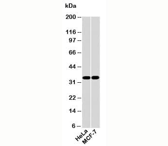 AIMP1 / EMAP II Antibody (C-Terminus)