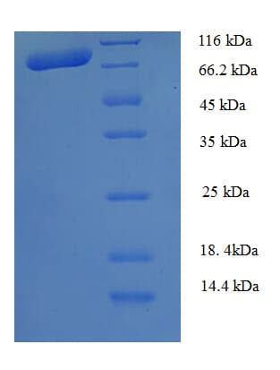 Human CAPN1 / Calpain 1 Protein (Recombinant 6His, N-terminus)