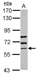 IHC-plus™ Polyclonal Rabbit anti-Human GBP5 Antibody (IHC, WB)
