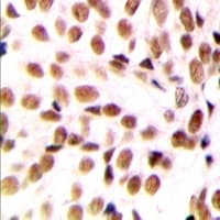 Polyclonal Rabbit anti-Human NFYB Antibody (N-Terminus, IHC, WB)