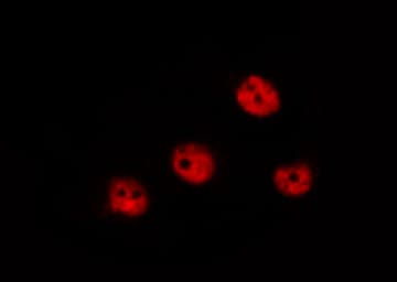 Polyclonal Rabbit anti-Human RB1 / Retinoblastoma / RB Antibody (phospho-Ser780, IHC, IF, WB)