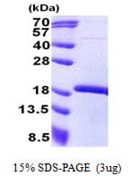 Human GAX / MEOX2 Protein (Recombinant His)