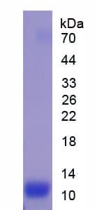 Mouse IL13RA2 / IL13R Alpha 2 Protein (Recombinant His)