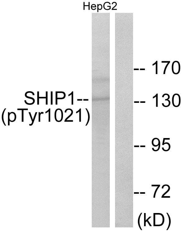 INPP5D / SHIP1 / SHIP Antibody (phospho-Tyr1021)