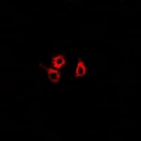 Polyclonal Rabbit anti-Human SMYD4 Antibody (IHC, IF, WB)