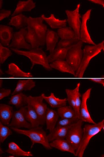 NQO2 Antibody