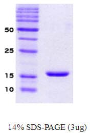 Human SNCA / Alpha-Synuclein Protein (Recombinant)