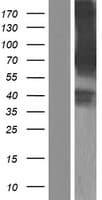 MGRN1 Protein (Over-Expression Lysate Myc-DDK (Flag))