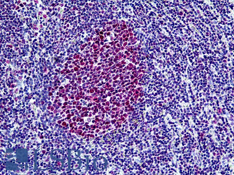 PathPlus™ SMARCA4 / BRG1 Antibody (aa2-14)