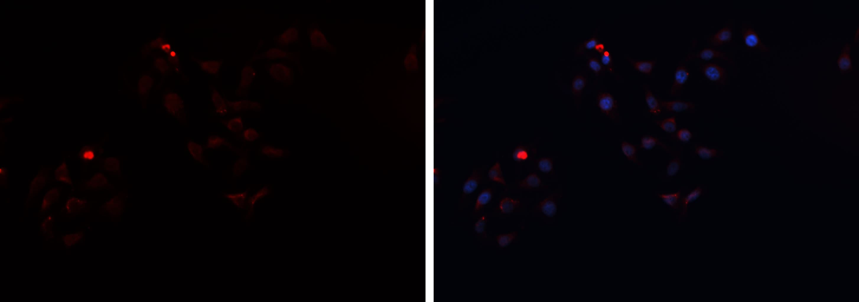 HP / Haptoglobin Antibody