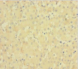 F11 / FXI / Factor XI Antibody