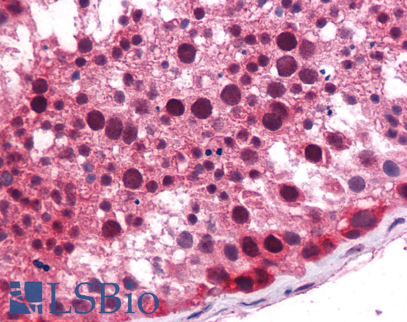 Polyclonal Rabbit anti-Human BTEB / KLF9 Antibody (aa38-87, IHC, WB)