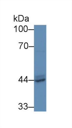 ACPP / PAP Antibody (aa56-215)