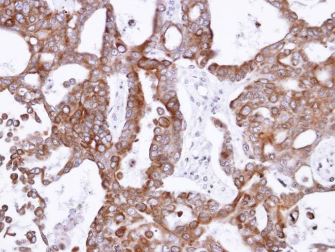 Polyclonal Rabbit anti-Human PANK1 / PANK Antibody (aa207-513, IHC, WB)