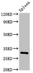 IL2RA / CD25 Antibody