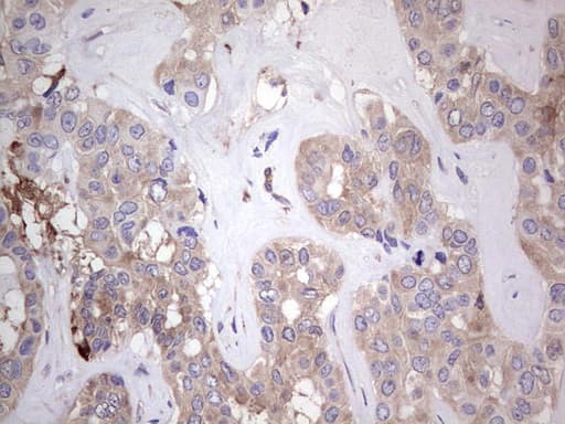 Monoclonal Mouse anti-Human PKM2 Antibody (clone 11B11, IHC, WB)
