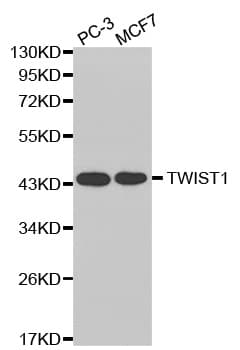 TWIST1 / TWIST Antibody