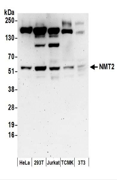 IHC-plus™ NMT2 Antibody (aa100-150)