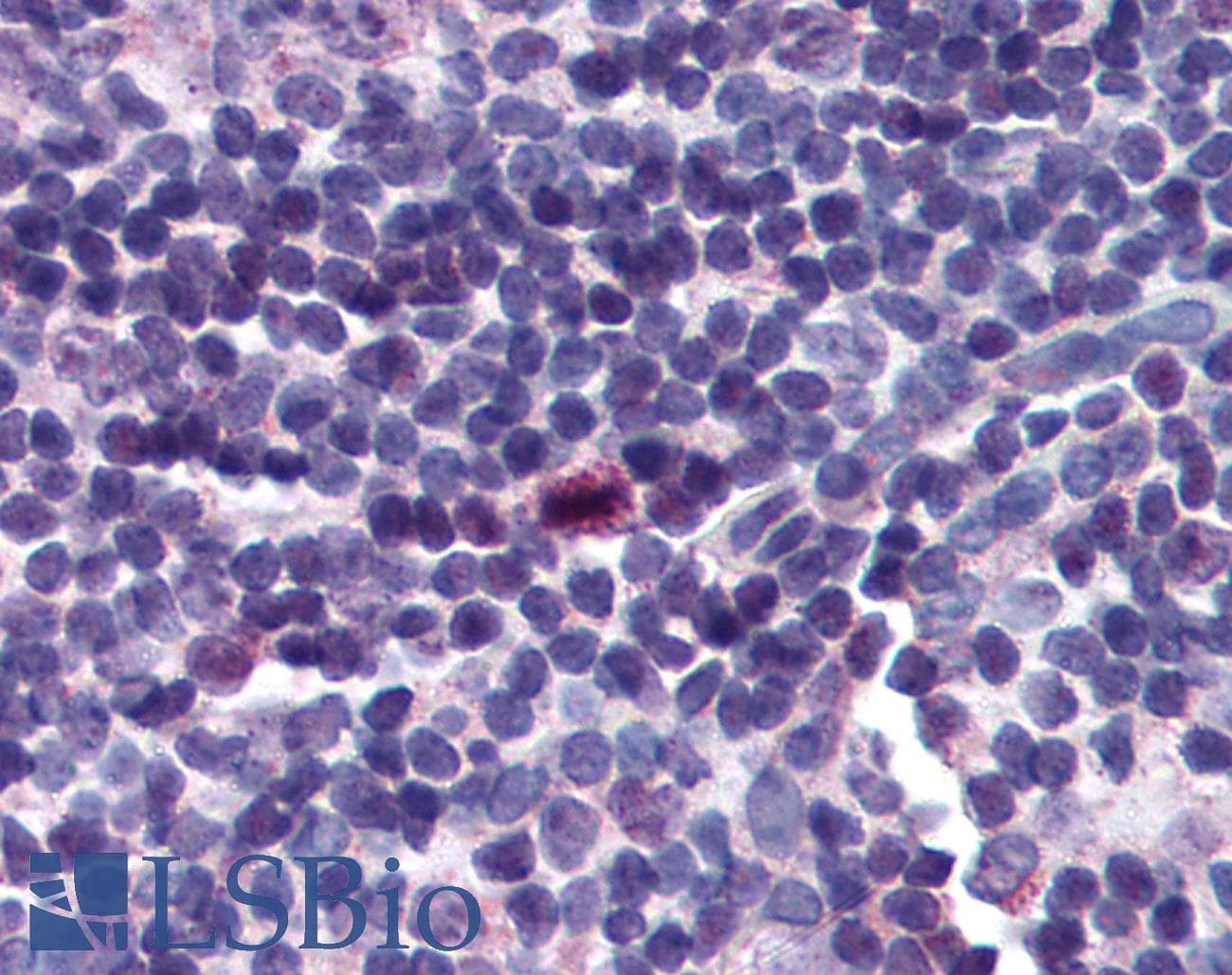 IHC-plus™ Polyclonal Rabbit anti-Human BIRC5 / Survivin Antibody (IHC, IF, WB)