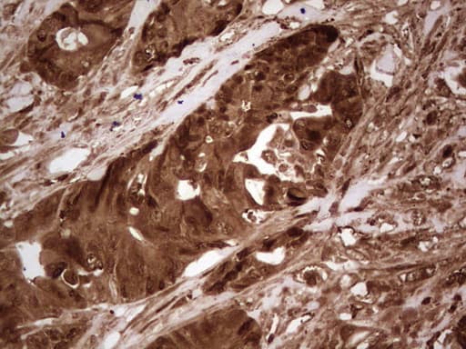 LGALS9 / Galectin 9 Antibody (clone OTI8B11)