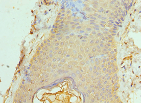 Polyclonal Rabbit anti-Human BAF53B / ACTL6B Antibody (aa1-280, IHC, WB)