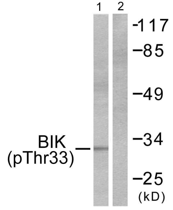 Polyclonal Rabbit anti-Human BIK Antibody (phospho-Thr33, IHC, WB)