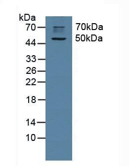 CHRM1 / M1 Antibody (aa210-363)