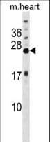 Polyclonal Rabbit anti-Human KCNIP4 / KCHIP4 Antibody (aa10-39, WB)