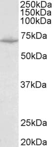 PathPlus™ SLC6A8 Antibody (aa212-226)